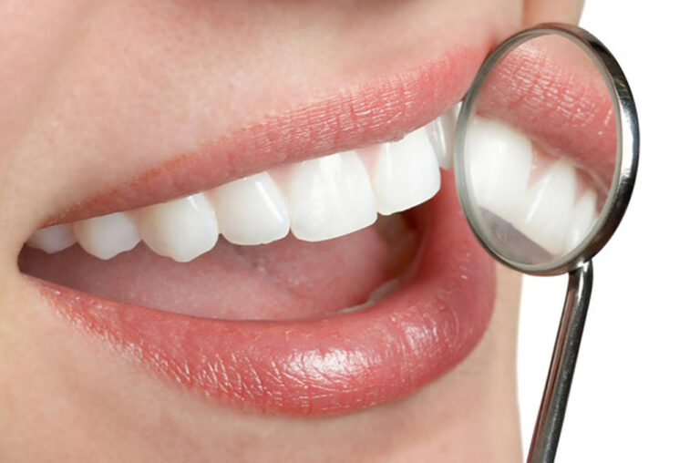 There Are Different Methods Of Tooth Restoration By Cosmetic Dentist In Kolkata