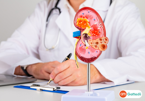 What Is the Cost of Kidney Surgery in India?