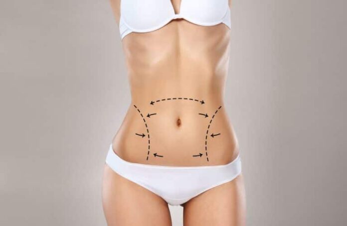 Comparing Techniques Best Full Body Liposuction Surgeon in Dubai and Their Approaches