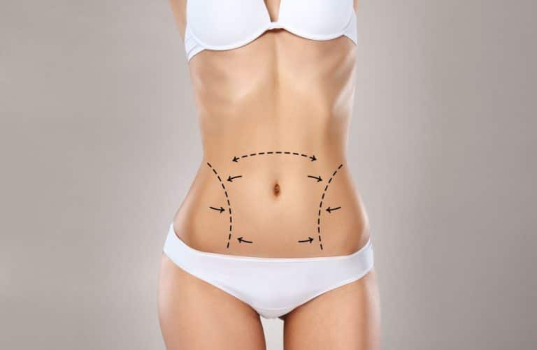 Comparing Techniques Best Full Body Liposuction Surgeon in Dubai and Their Approaches