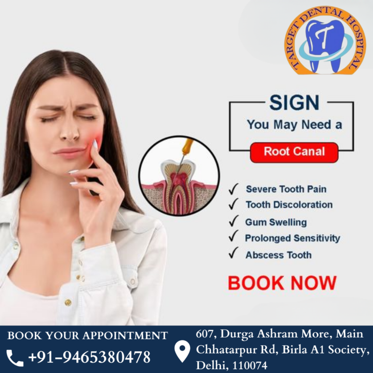 Best Root Canal Treatment in Chhatarpur : Target Dental Hospital