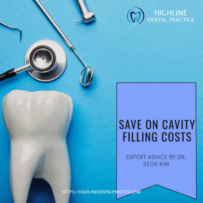 Cavity Filling Costs