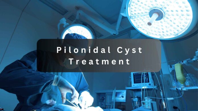 pilonidal cyst treatment