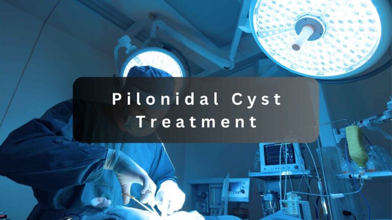 pilonidal cyst treatment